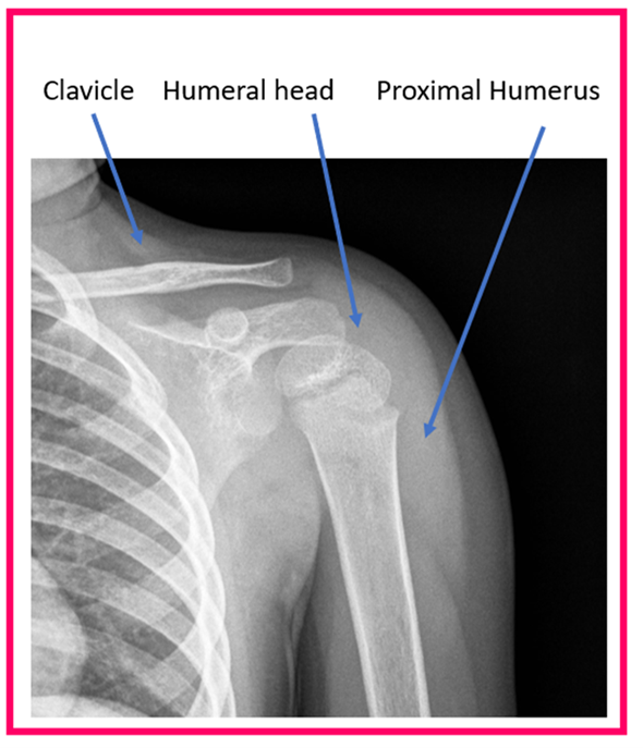 normal humerus x ray growth plates